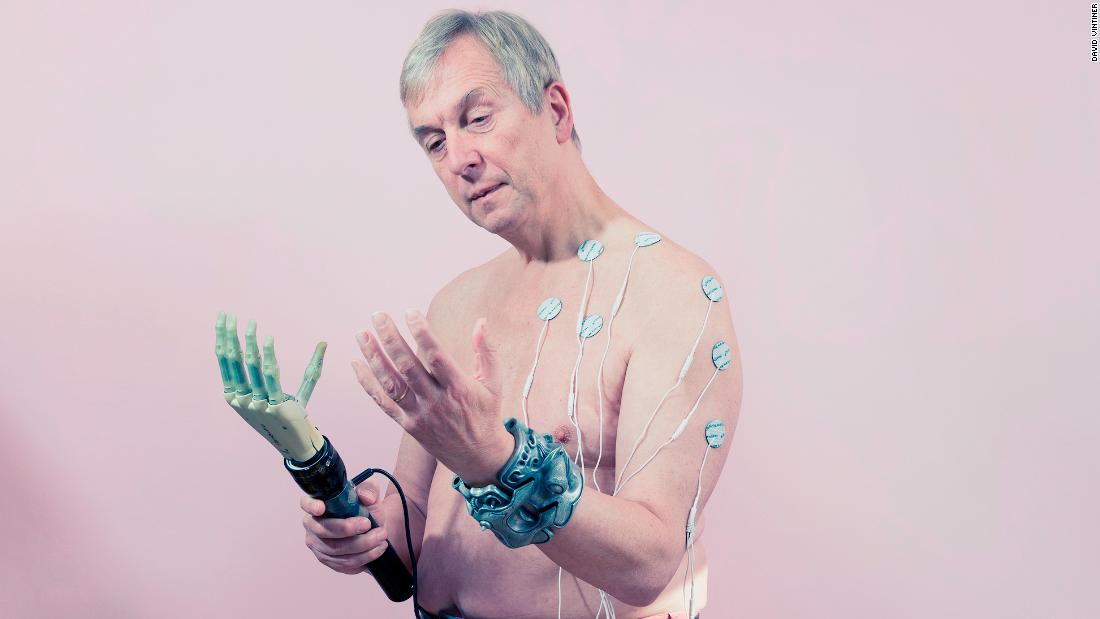 Transhumanism: cyborgs and biohackers redefining beauty ideals