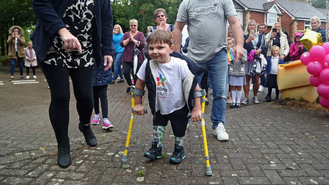 5-year-old boy Tony Hudgell with prosthetic legs raised $ 1 million for the NHS