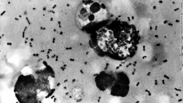 Every year, 1,000 to 2,000 people get plague - including about 7 in the U.S.