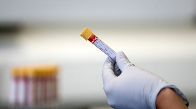 File photo dated 05/06/20 of a paramedic holding a test tube containing a blood sample at a coronavirus antibody testing program at the Hollymore Ambulance Hub of the West Midlands Ambulance Service in Birmingham. A factory in West Lothian is expanding as part of a deal to secure 60 million doses of a coronavirus vaccine candidate developed by the French firm Valneva.